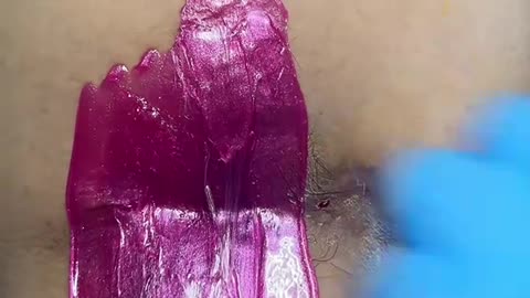 💗 Underarm Waxing on HS Client Using Tickled Pink Hard Wax | @waxingqueenadventures