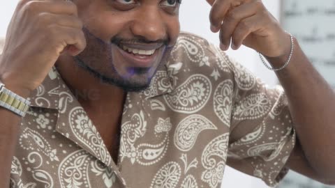 The afro hair transplant procedure or Bear transplant at Long Hair Center