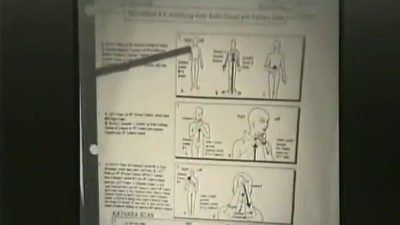 Advanced Kathara Bio Spiritual Healing level 1 intro level 2 part 9 of 12 Ashayana Deane