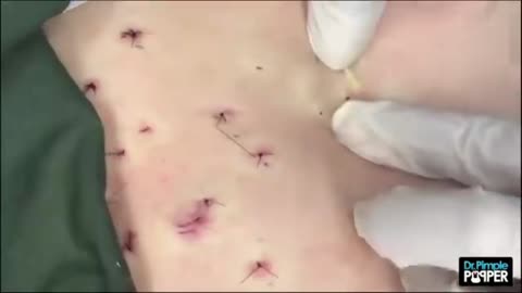 Dr Pimple Popper s Weekly Story Time Momma Squishy