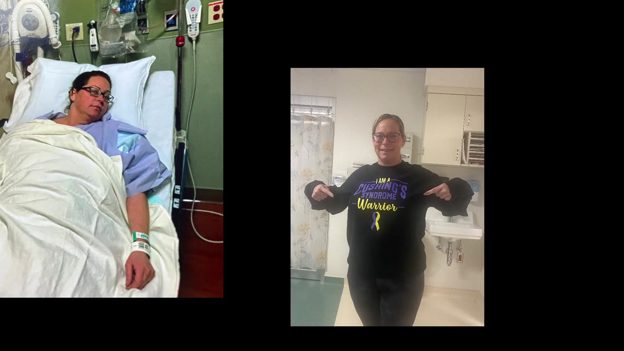 Struggle is real "ESSURE"