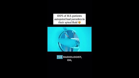 100% of MS patients autopsied had parasites in their spinal fluid...