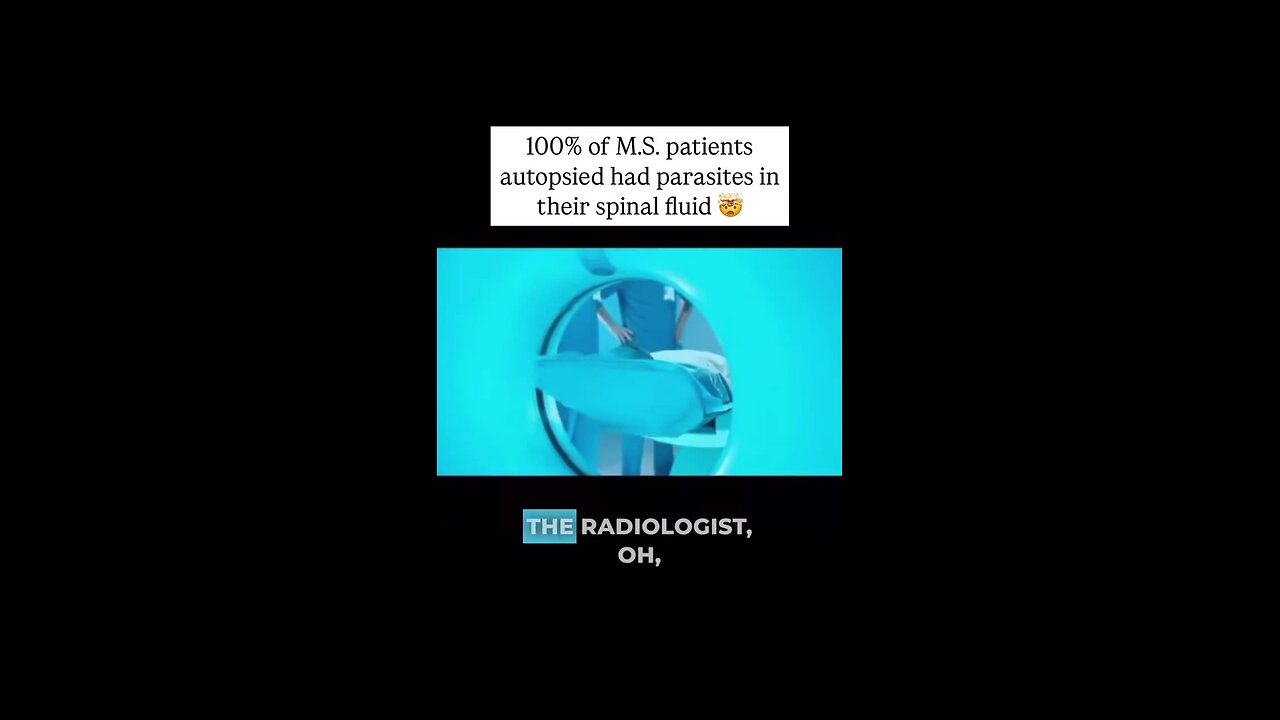 100% of MS patients autopsied had parasites in their spinal fluid...