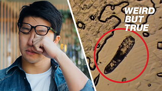 Gross eyelash mites live rent-free on your face — here's how to stop them | Weird But True