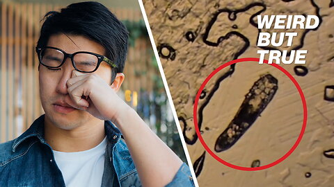 Gross eyelash mites live rent-free on your face — here's how to stop them | Weird But True