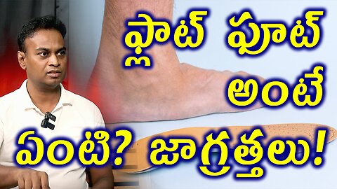 ఫ్లాట్ ఫూట్ అంటే ఏంటి? జాగ్రత్తలు What Is Flat Foor and Its Homeopathy Medicine Precautions Cure