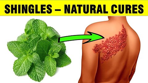How to get rid of Shingles