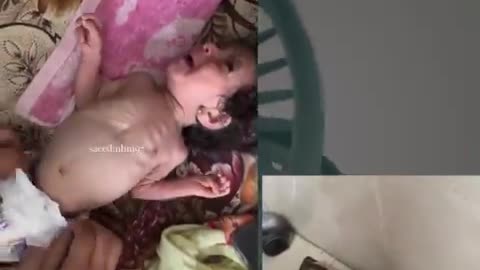 Gaza: Palestinians exploit disabled children and Yemeni starvation victims for their propaganda