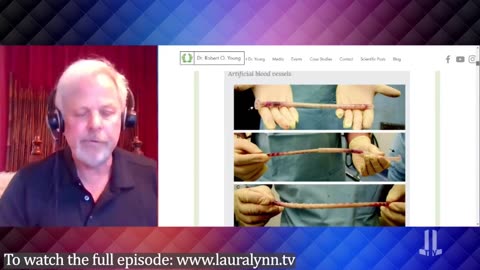 Dr. Robert Young Reveals Shocking Autopsy Findings in the Jabbed – Pilots at Risk