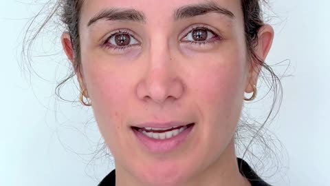 Lateral Canthoplasty (Outer Eye Lengthening): 1 Week Post-Op Results | Dr. Kenneth Kim