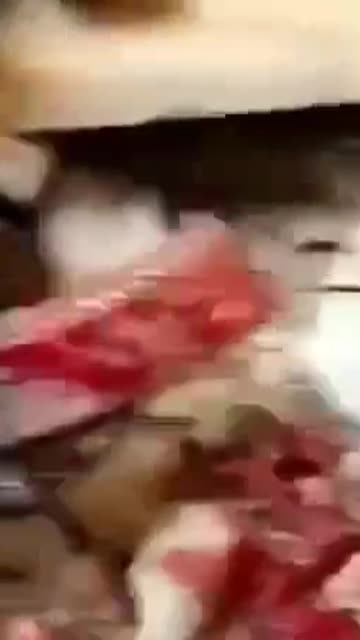 Wounded Russian Soldier Says Goodbye