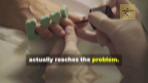 Fix Your Toenail Fungus with Metanail Serum Pro