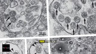 Virology — A Critique of Its Foundations - Mike Stone