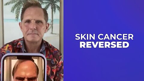 SKIN CANCER ♋️ REVERSED