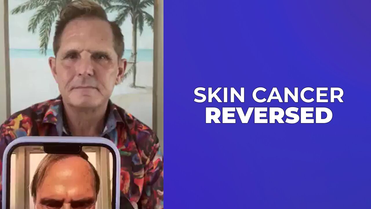 SKIN CANCER ♋️ REVERSED