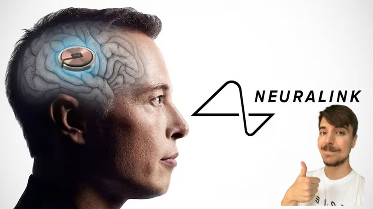 Mr Beast Just Normalized Neuralink to Millions
