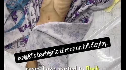 WDF