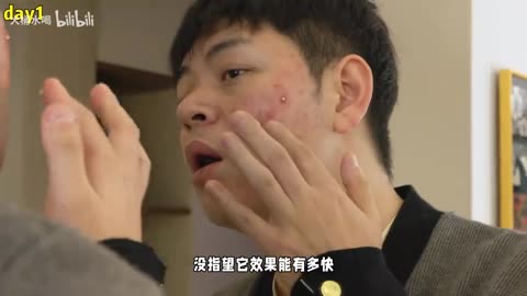 211 Medical Student’s Acne Treatment Journey