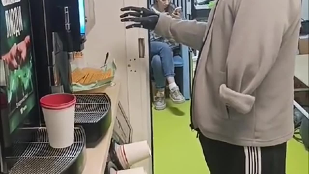 🩺🦾 Medical Innovation | Patient Testing Advanced Prosthesis | RCF