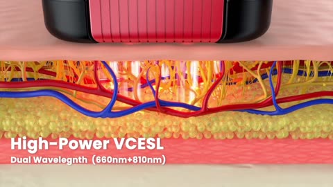 MATELASER W1 REGEN by Matelaser — Kickstarter