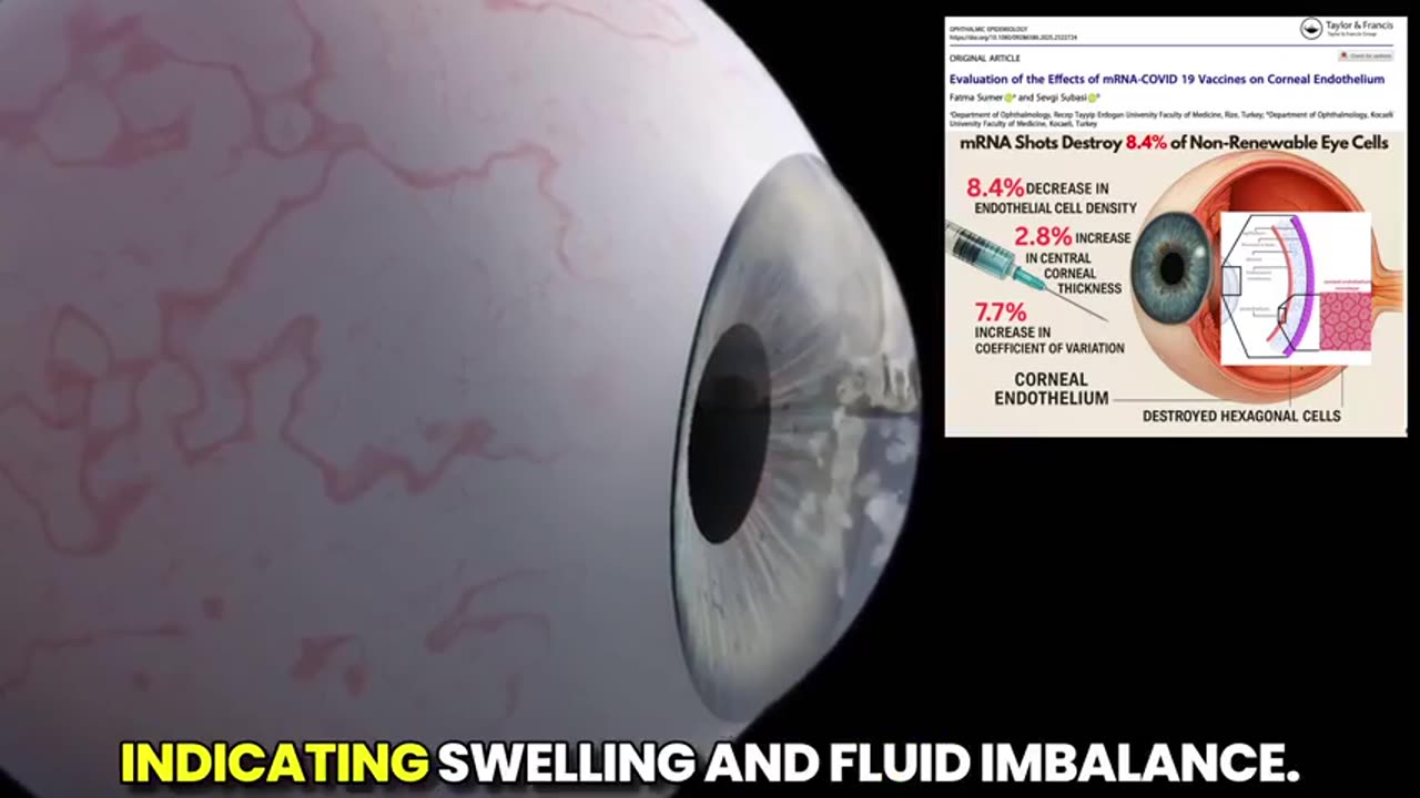 Covid Bioweapon Shots Destroy 8.4% of Non-Renewable Eye Cells.