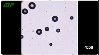 Optical microscope analysis of the measles, mumps, and rubella vaccine, with an expiration date of 2026