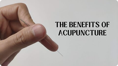 Acupuncture Benefits: Natural Healing for Better Living