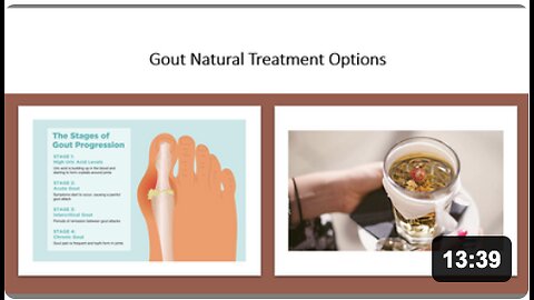 Gout - Natural Treatment Options