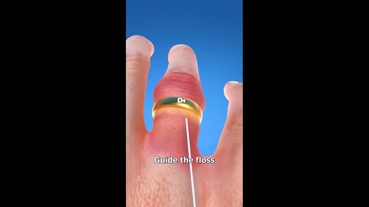 if ring is stuck finger #educational #entertainment