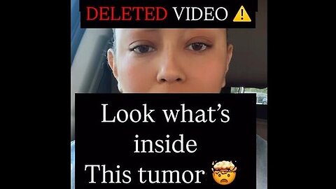 DELETED VIDEO Look What's Inside This Tumor