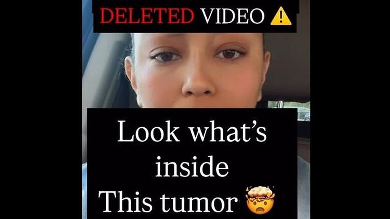 DELETED VIDEO Look What's Inside This Tumor