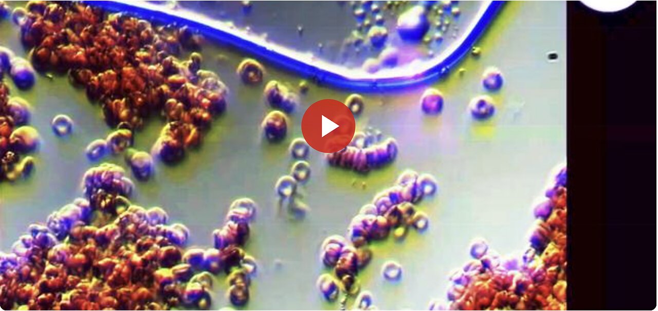 BLOOD of ''VAXXINATED'' + ULTRAVIOLET PULSE (La Quinta Columna)
