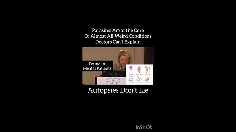 Mom Of An Autistic Boy Addresses Parasites