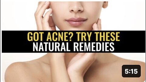 "Natural Remedies to Try for Acne"