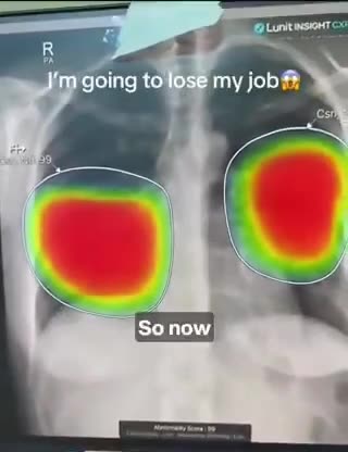 AI Diagnostics in Healthcare