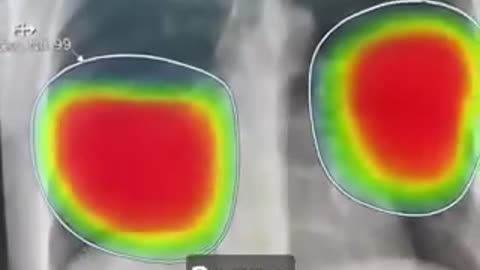 AI Diagnostics in Healthcare
