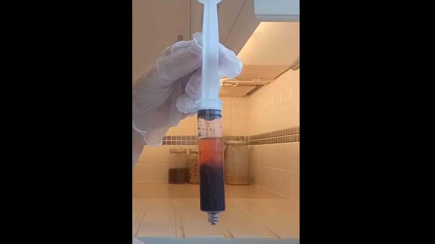 EDTA & Vit C Breaking down Rubbery Clots