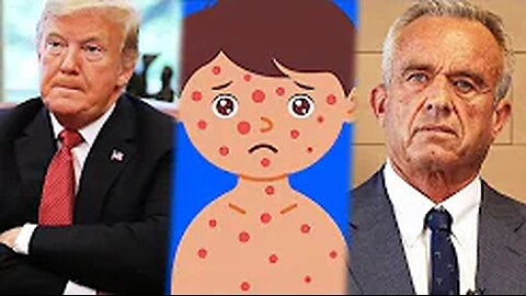 Measles CATASTROPHE as Trump CAN’T CONTROL monster he created