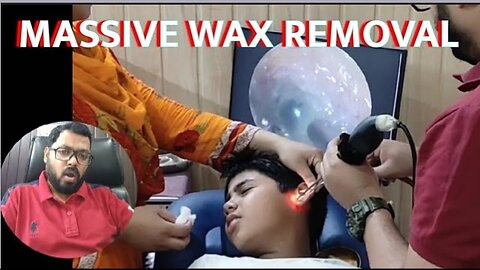 MASSIVE WAX |CHAP 2|ENDOSCOPIC EAR WAX |