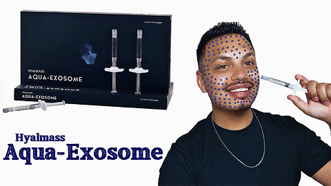 Join Me As I Do A Full Face MesoTherapy Using Aqua-Exosome