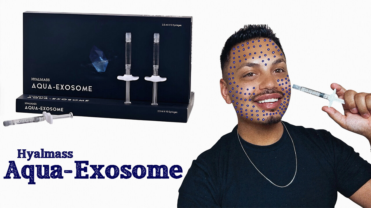 Join Me As I Do A Full Face MesoTherapy Using Aqua-Exosome