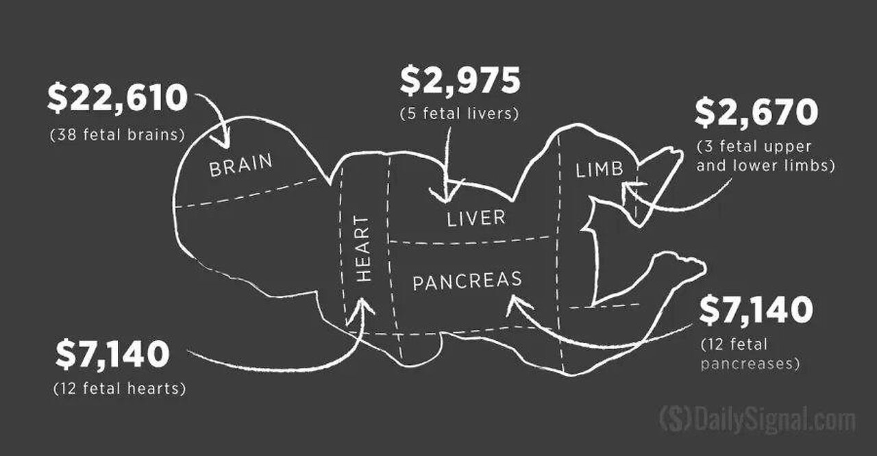This proves Abortion is modern day’s child sacrifice - No new thing under the sun.