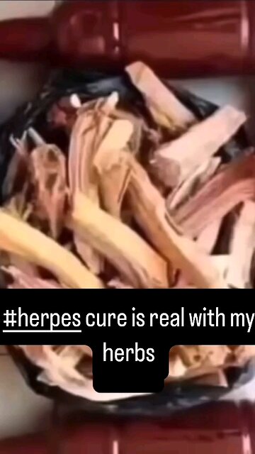 Get Rid Of #Herpes with my natural herbs Dm on Whatsapp: +2348152259304 drewicuringherprs@gmail.com