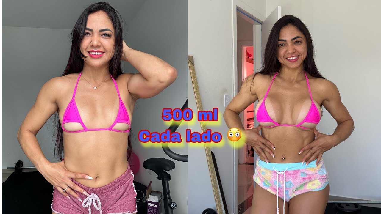 Antes e Depois do Silicone com biquini