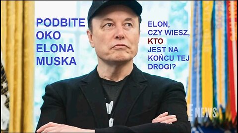 QUEEN MERCURY ELON MUSK SPORTS BLACK EYE ILLUMINATI HOLLYWOOD LADY GAGA JUSTIN BIEBER SHARON STONE