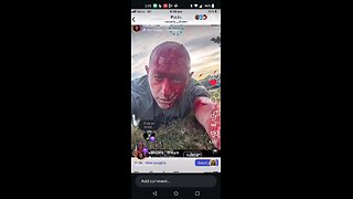 Israeli Propagandist Crisis Actor