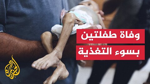 وفاة شخص وطفلتين في غزة بسبب سوء التغذية الناتج عن الحصار الإسرائيلي