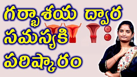 గర్భాశయ ద్వార సమస్యకి పరిష్కారం Solution for Cervix Problems in Women | Cervicitis Homeopathy Cure