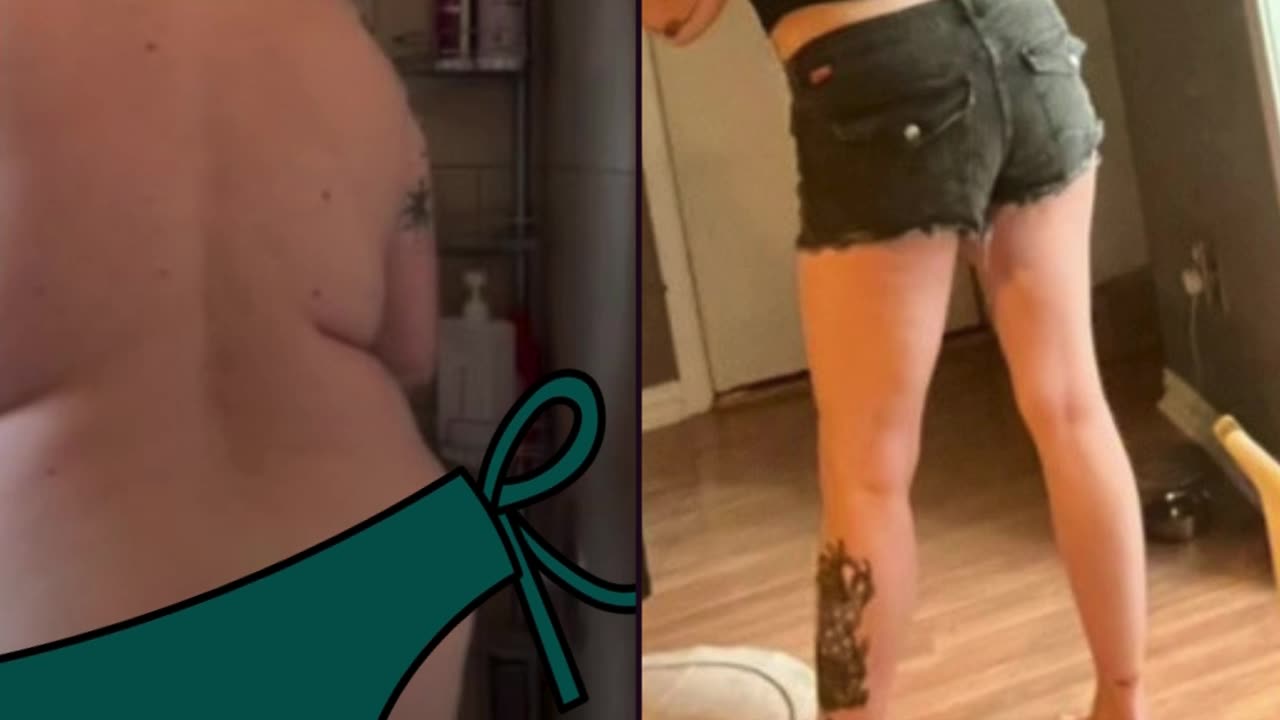 Before and After GLP-1, GIP, Glucagon Peptides