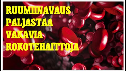 Ruumiinavaus paljastaa vakavia rokotehaittoja